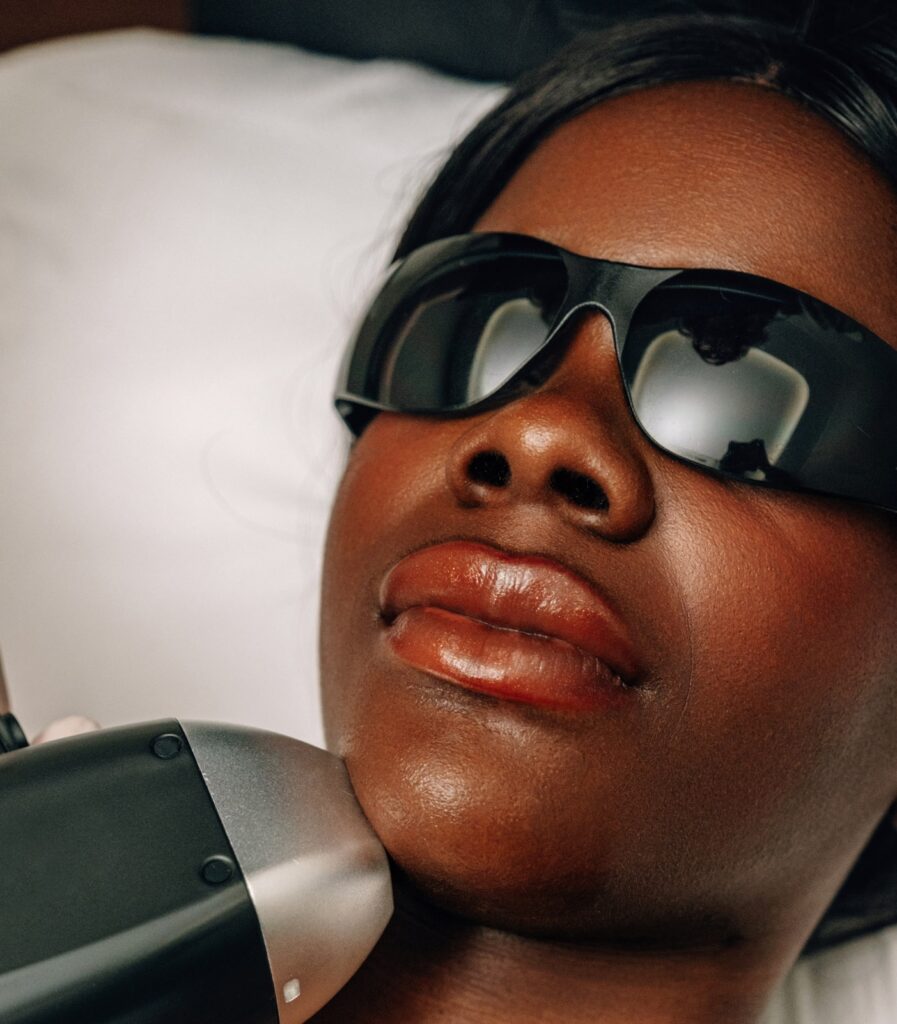 Laserontharing van de bovenlip van een dame door Glizz
