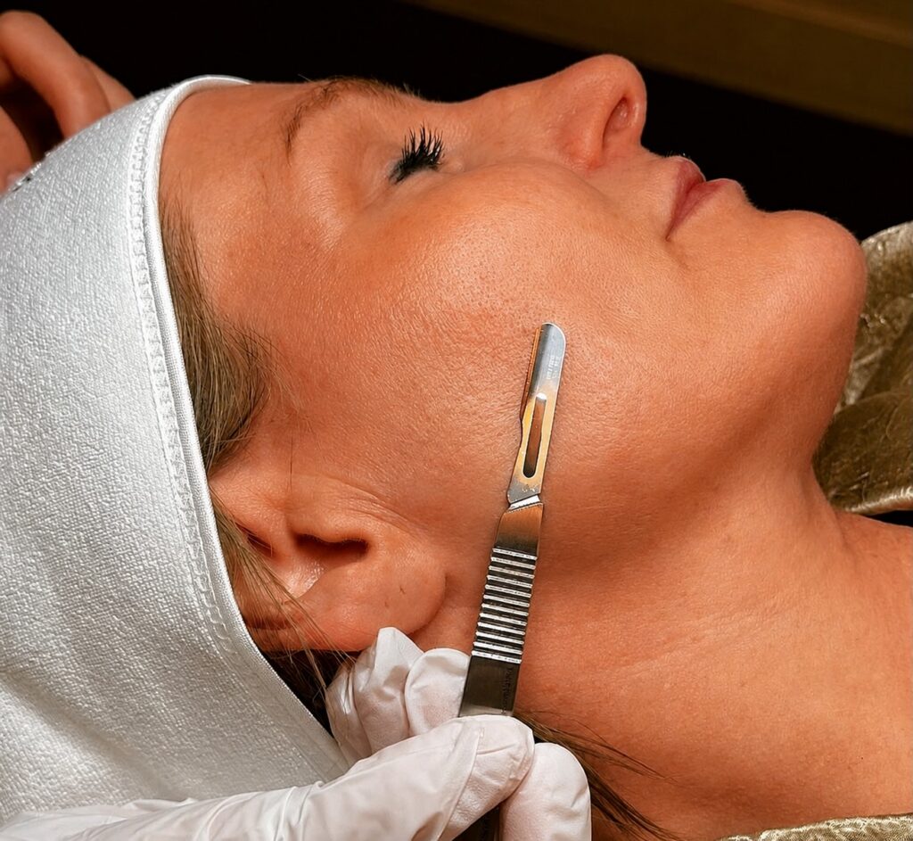 Schoonheidsspecialiste voert dermaplaning uit op de wang van een cliënte