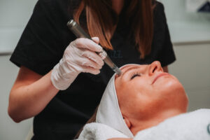 Schoonheidsspecialiste voert Microneedling uit op het voorhoofd van een cliënte